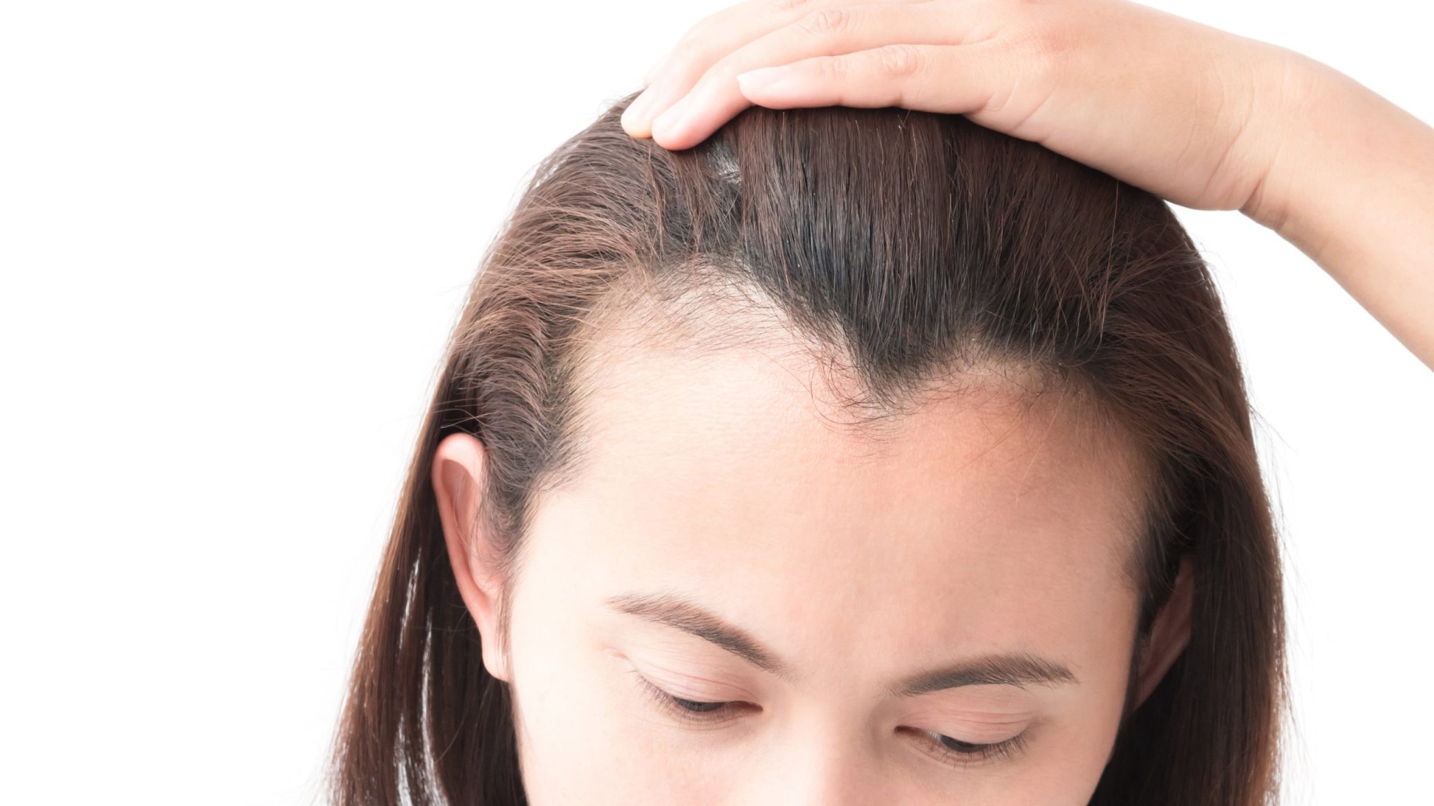 Tips to Prevent Hair Loss - My health beauty tips