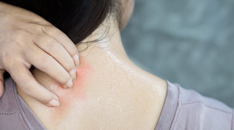 Heatrash1